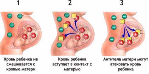 Последние два инвазивных анализа могут привести к тяжёлым осложнениям, поэтому показаниями к ним будут высокий титр антител и гибель плода от конфликта крови в прошлом